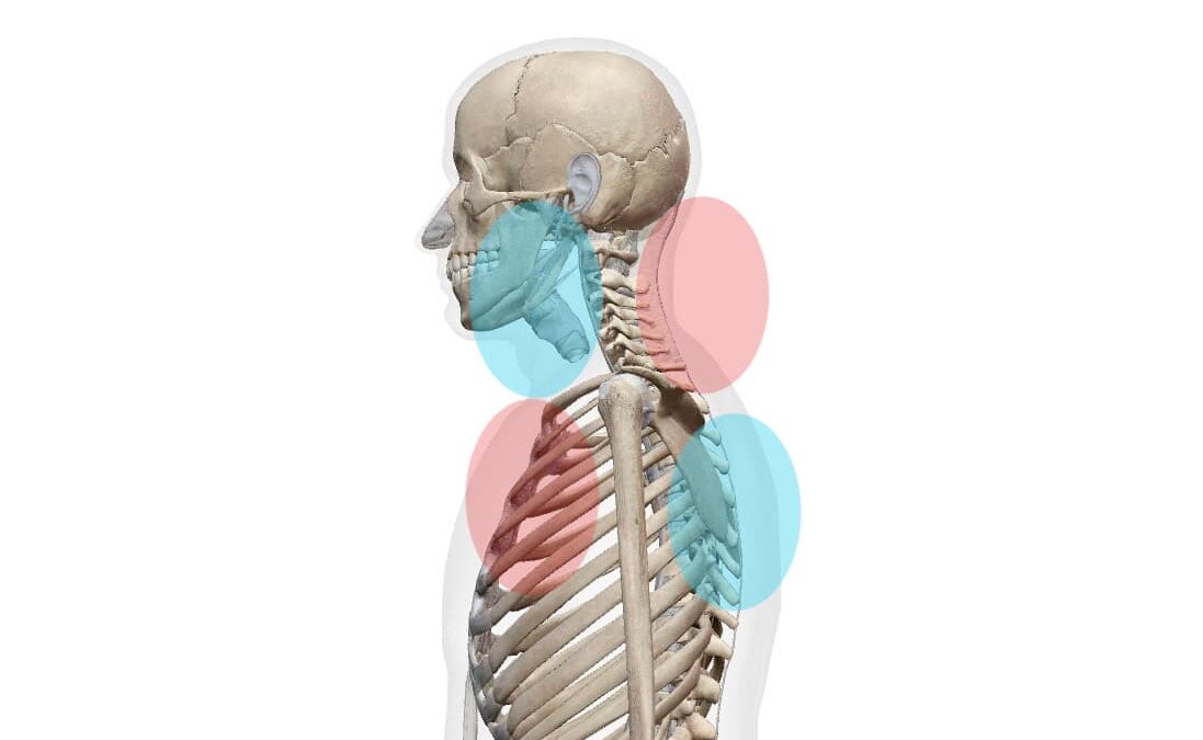 上位交差症候群画像