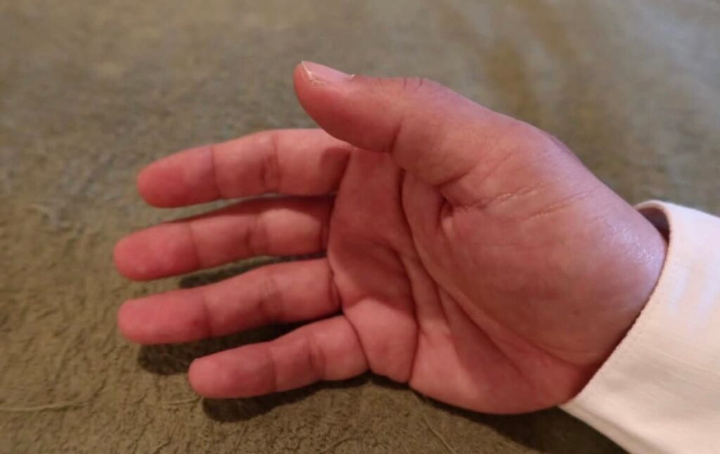 施術者の手の画像